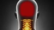 Silhouette of person, the cervical spine is highlighted and the head is highlighted in red, indicating pain.