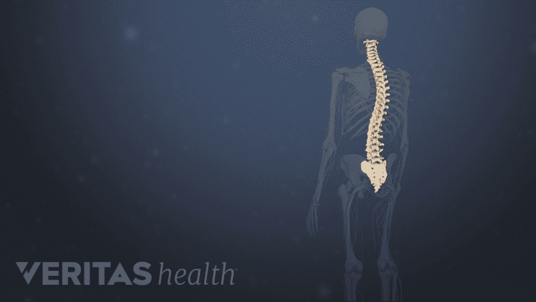 Adult spine scoliosis.