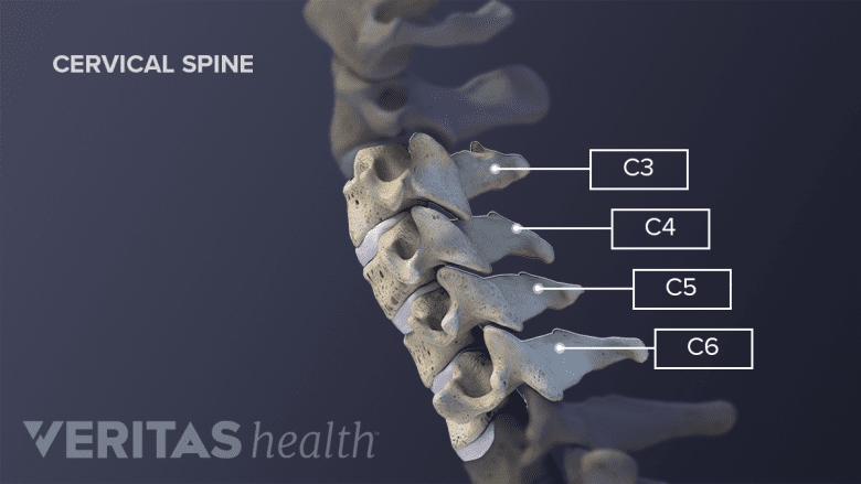 Profile view of C3, C4, C5, and C6 cervical vertebrae.