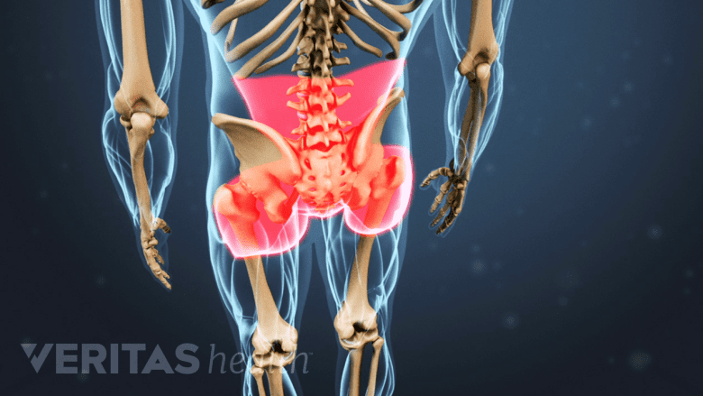 hip pain causing low back pain.