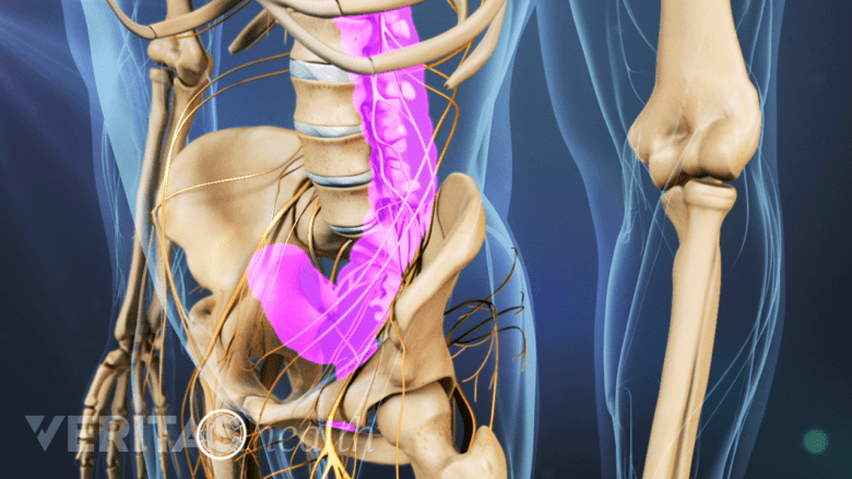 Illustration showing pelvic region with highlighted bowel area.
