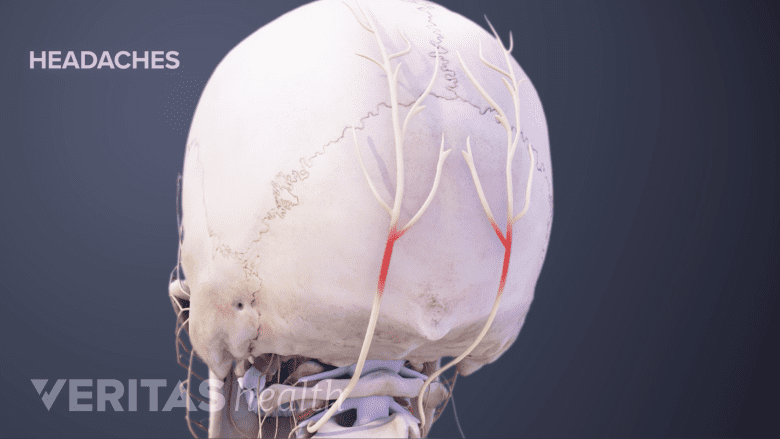 Illustration showing posterior skull with red highlights.