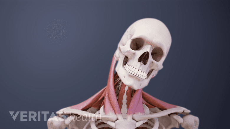 A skull tilted to one side.