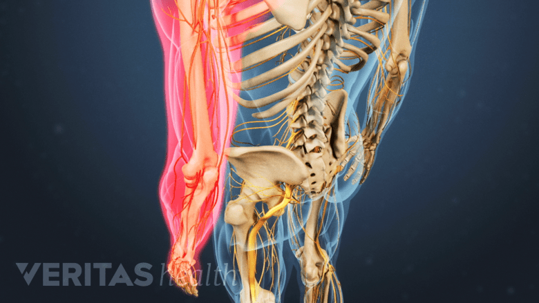 An illustration showing area pain highlighted in red.