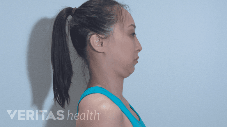 A woman performing chin tuck exercise.