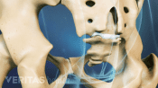 Posterior view of pelvis showing the coccyx.