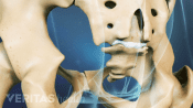 Posterior view of pelvis showing the coccyx.