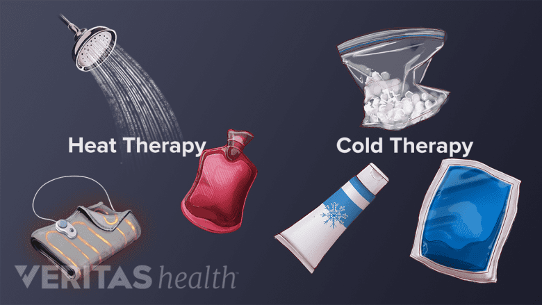 An illustration showing various ice and heat therapy techniques.
