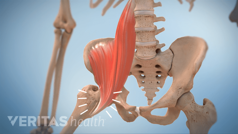 An illustration showing  ligament snapping against the bone.
