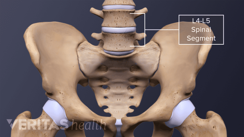 Anterior view of the spine and pelvis with the L4-L5 vertebral segment labeled.