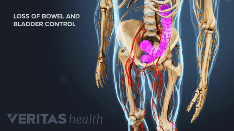 Illustration of pelvis with bowel and bladder highlighted in pink.