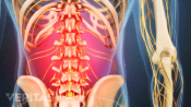 Posterior view of the lower back and pelvis highlighting low back pain.