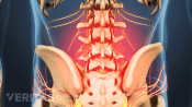 Posterior view of the lower body showing pain in the lumbar spine.