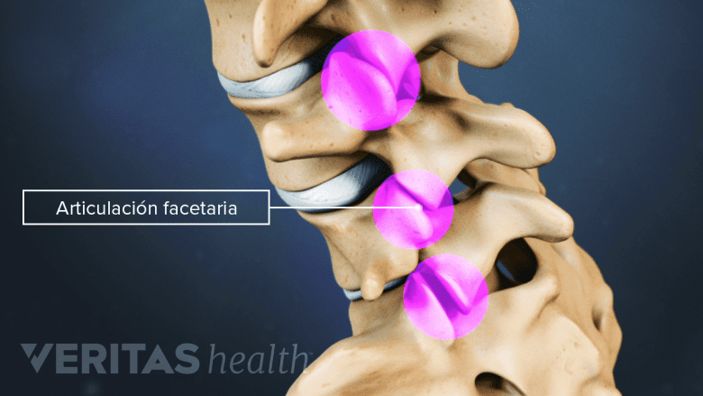 La articulación facetaria de una vértebra lumbar.