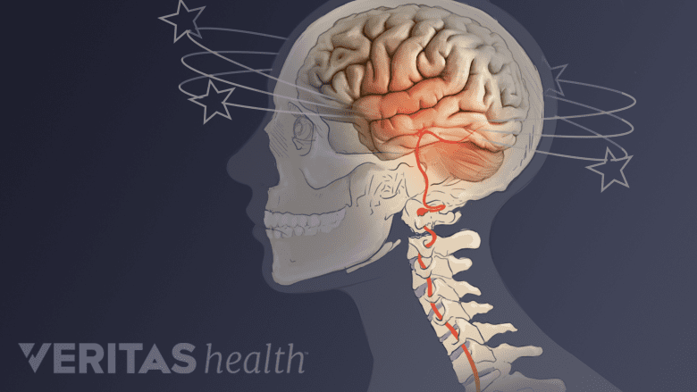 Illustration showing side view of head and neck.