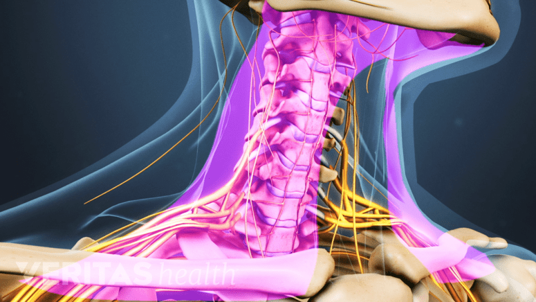 Profile view highlighting neck pain