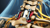 Posterior view of fusion screws in the cervical spine.