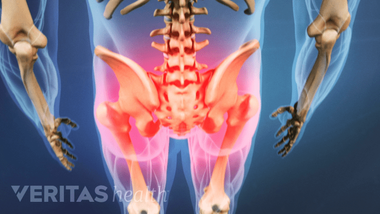 Illustration showing pelvis with lower back area highlighted in red.