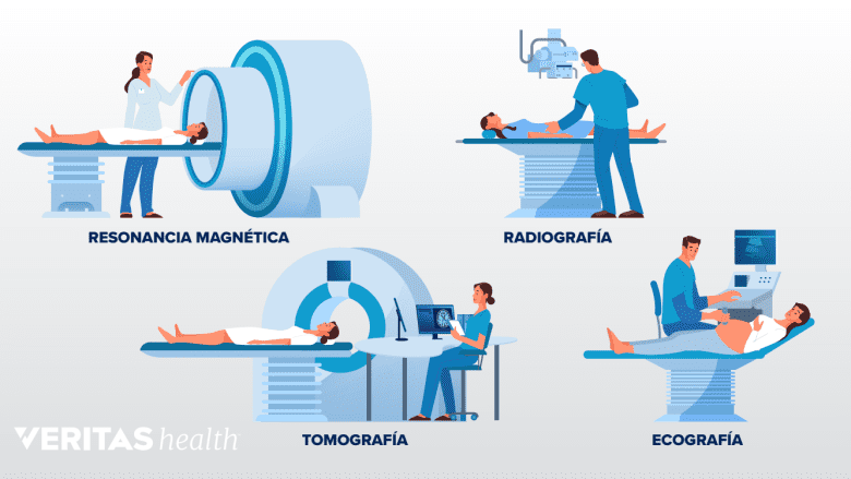 Varias técnicas de imagen.