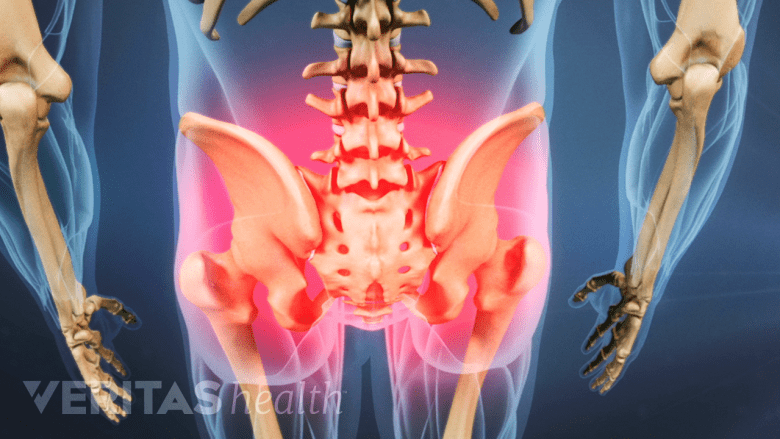 Highlighted area showing muscle tightness and pain in the lower back and pelvis.