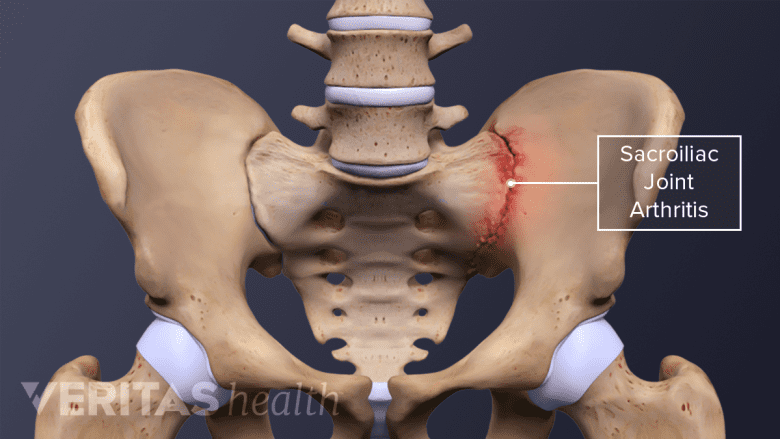 3D rendering of the hip bone of the human skeleton. Highlighting the SI Joint.