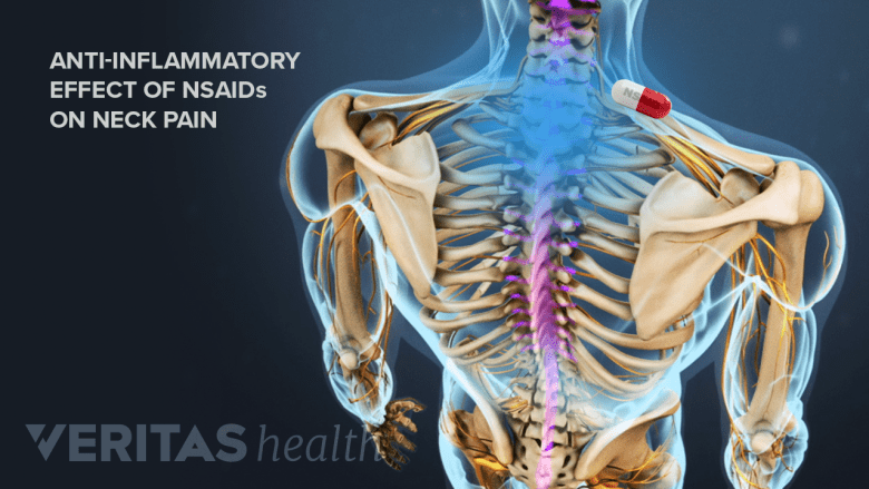 Illustration showing adult spine with neck area highlighted in blue.