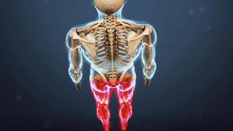 An illustration showing highlighted legs indicating weakness in both legs.