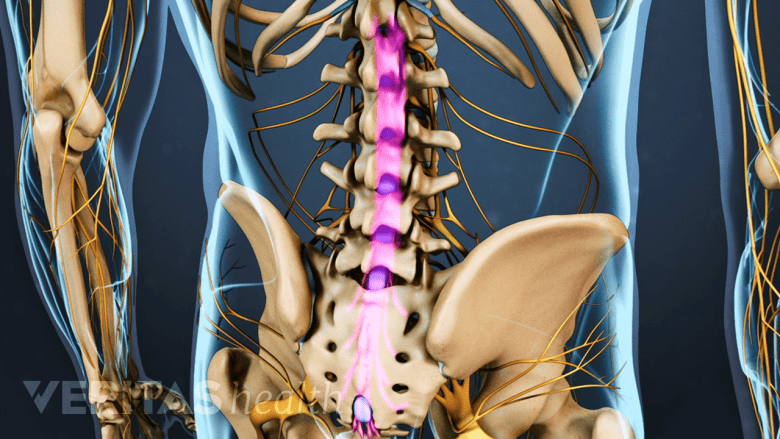 Illustration of the lower back anatomy of a human. Highlighting the nerves in the lumbar spine that make up the cauda equina.