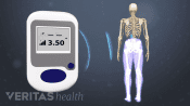Controller sending pain control signals for lower back pain to generator implanted in the body during spinal cord stimulation