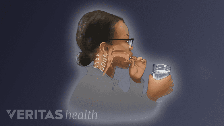 Illustration showing a woman swallowing  a pill.