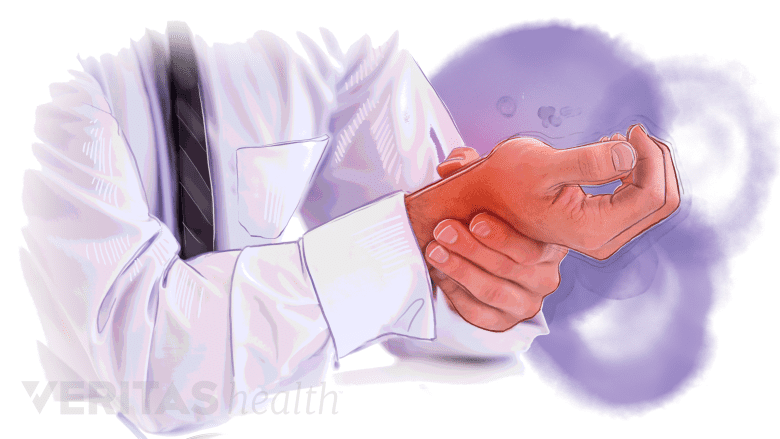 A man with his wrist having a red hue.